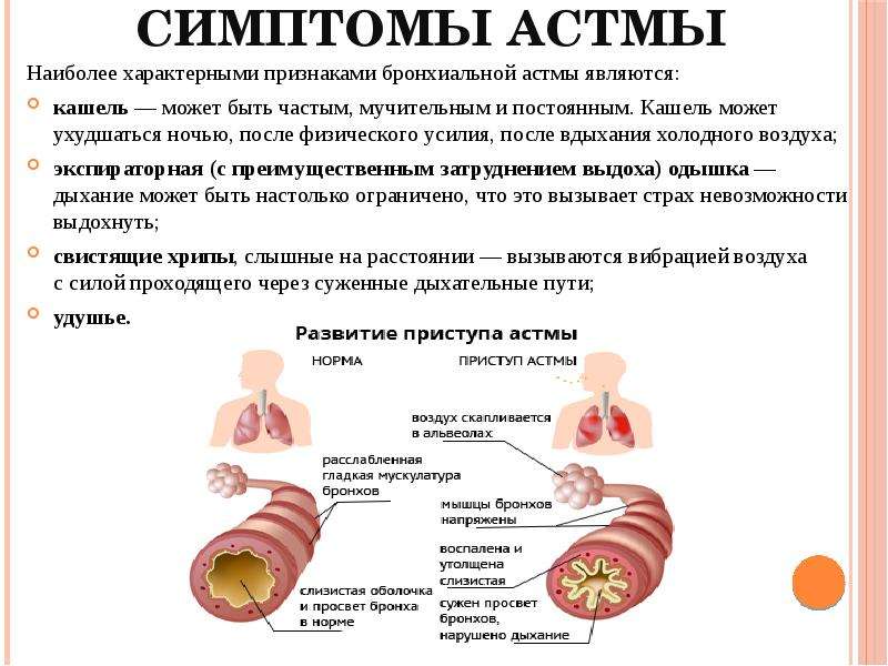 Как начинается бронхиальная астма симптомы - Признаки астмы у взрослого: подробная информация о симптоматике