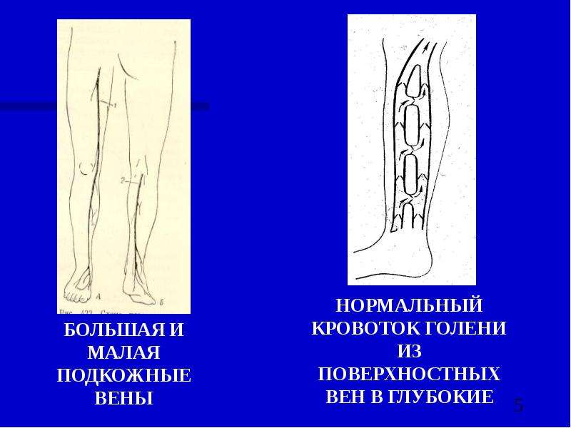 Варикоз 911 Украина