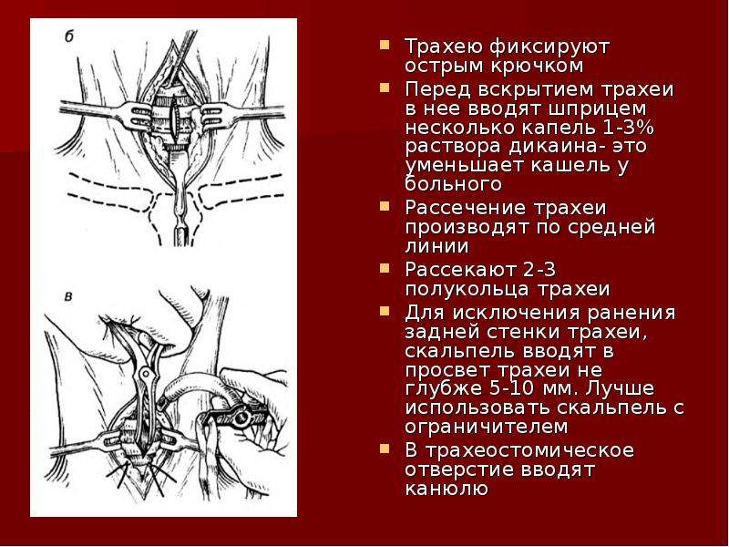 Отец Изначально Трахеи Порно Дочь Деревянко Русский