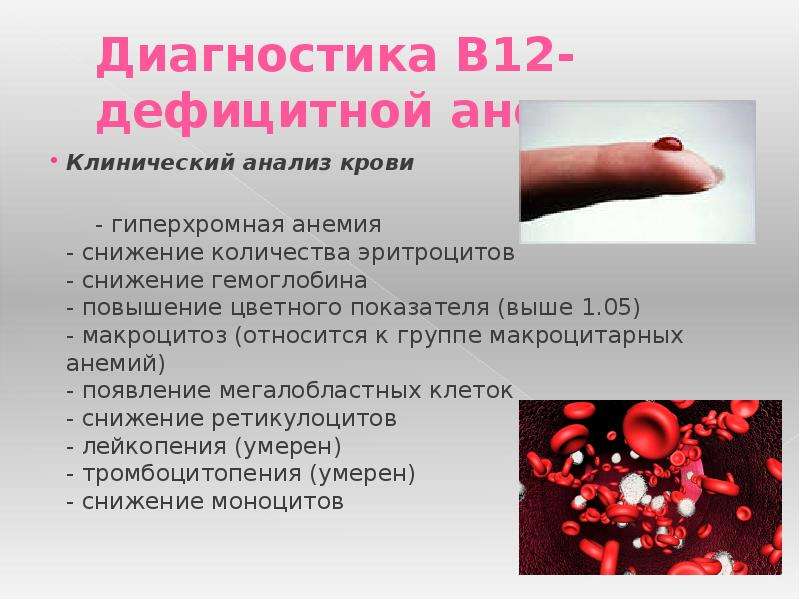   Диагностика В12-дефицитной анемии: 
Клинический анализ крови   - гиперхромная анемия
- снижение количества эритроцитов 
- снижение гемоглобина 
- повышение цветного показателя (выше 1.05) 
- макроцитоз (относится к группе макроцитарных анемий) 
- появление мегалобластных клеток
- снижение ретикулоцитов 
- лейкопения (умерен)
- тромбоцитопения (умерен)
- снижение моноцитов   