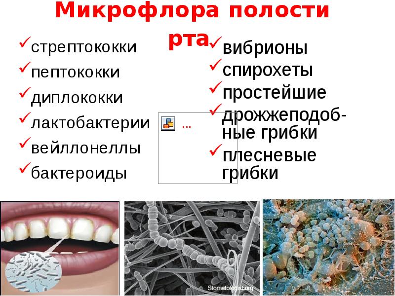   Микрофлора полости рта 
стрептококки
пептококки
диплококки
лактобактерии
вейллонеллы
бактероиды
