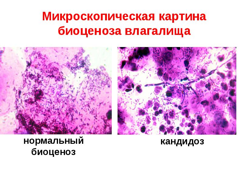 Микрофлора тела человека, слайд №22