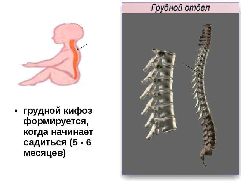   грудной кифоз формируется, когда начинает садиться (5 - 6 месяцев) 
грудной кифоз формируется, когда начинает садиться (5 - 6 месяцев)  