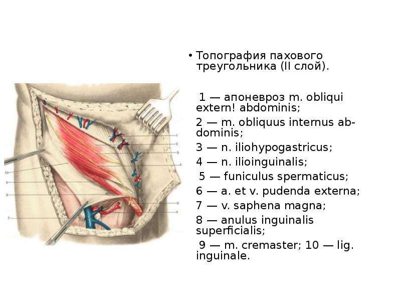   Топография пахового треугольника (II слой).
 1 — апоневроз m. obliqui extern! abdominis; 
2 — m. obliquus internus ab-dominis; 
3 — n. iliohypogastricus; 
4 — n. ilioinguinalis;
 5 — funiculus spermaticus; 
6 — a. et v. pudenda externa; 
7 — v. saphena magna; 
8 — anulus inguinalis superficialis;
 9 — m. cremaster; 10 — lig. inguinale.
