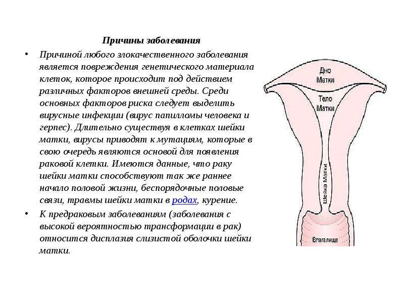   Причины заболевания
 Причины заболевания
Причиной любого злокачественного заболевания является повреждения генетического материала клеток, которое происходит под действием различных факторов внешней среды. Среди основных факторов риска следует выделить вирусные инфекции (вирус папилломы человека и герпес). Длительно существуя в клетках шейки матки, вирусы приводят к мутациям, которые в свою очередь являются основой для появления раковой клетки. Имеются данные, что раку шейки матки способствуют так же раннее начало половой жизни, беспорядочные половые связи, травмы шейки матки в родах, курение.
К предраковым заболеваниям (заболевания с высокой вероятностью трансформации в рак) относится дисплазия слизистой оболочки шейки матки.  