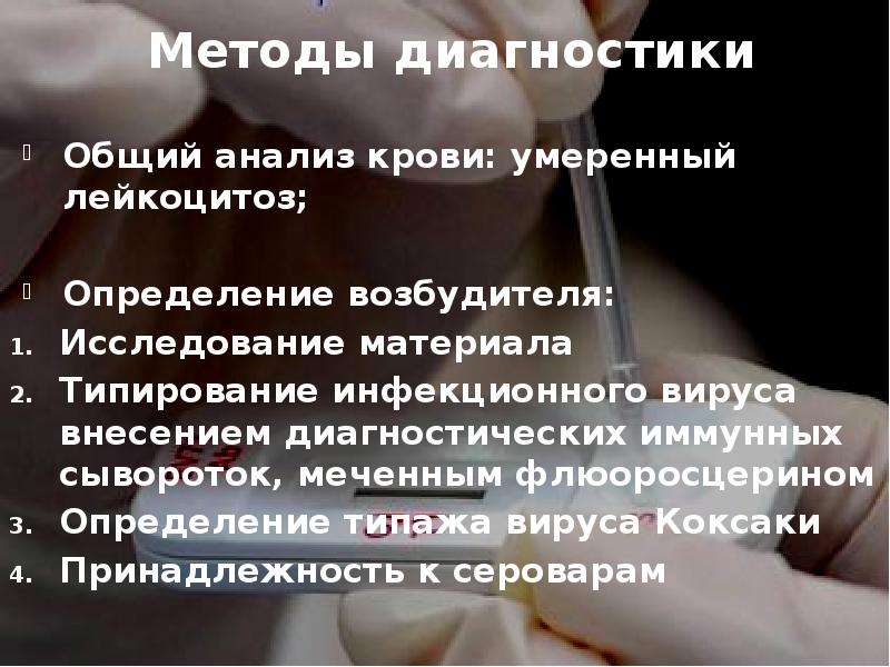 Коксаки вирус диагностика что это такое