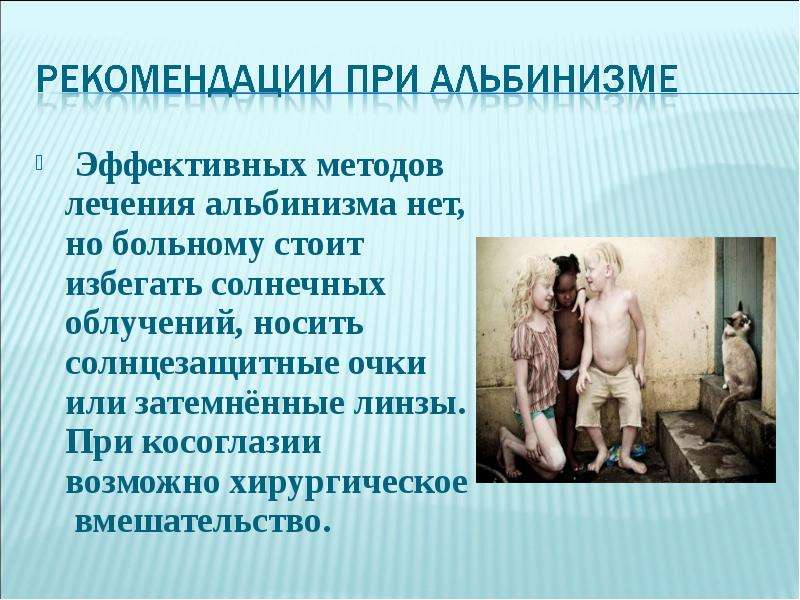 Презентация про альбинизм