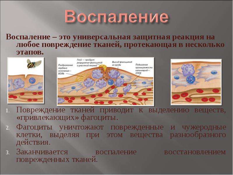 Реакция в тканях. Фазы воспалительного процесса в соединительной ткани. Воспалительных процессах в тканях. Воспалительная реакция.