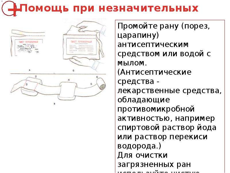 1 помощь при порезе. Оказание первой помощи при порезах и кровотечениях. Алгоритм при резаной ране. Первая помощь при Глубоком порезе. Первая помощь при порезах кратко по пунктам.