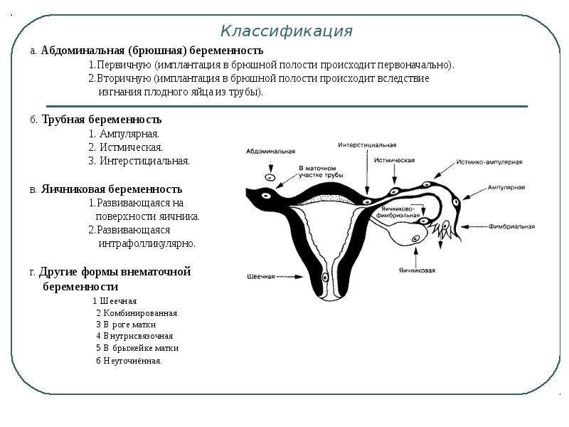 Маточные трубы удаление месячные. Трубная беременность классификация. Внематочная Трубная ампулярная беременность. Внематочная беременность схема. Истмическая внематочная беременность.