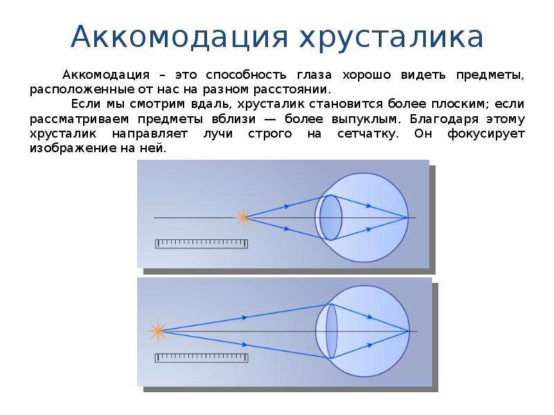 Аккомодация глаза. Схема аккомодации хрусталика. При включении аккомодации хрусталик становится. Аккомодация хрусталикмэто. Объясните схему аккомодации хрусталика.