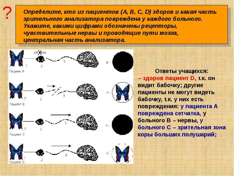 Рассмотрите рисунок 138 укажите у кого из пациентов зрение нормальное и какими нарушениями зрения