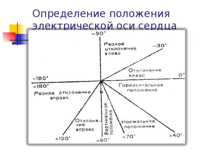 Оси сердца рисунок