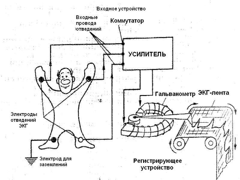 Схема электрокардиографа эк1т 03м - 94 фото