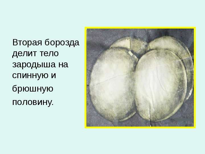 



Вторая борозда делит тело зародыша на спинную и 
брюшную 
половину.
