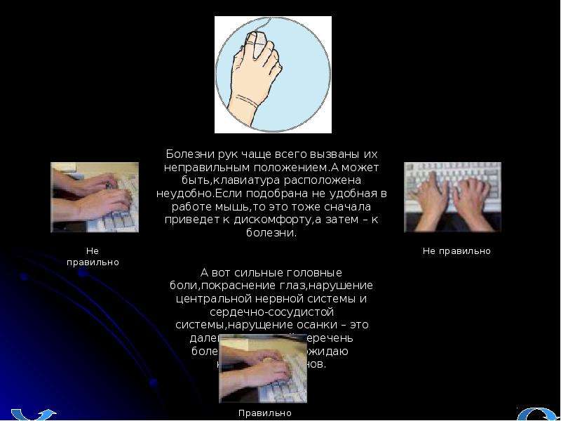 Болезнь запястья от компьютерной мышки. Положение руки при работе с мышкой. Правильное и неправильное положение руки в лампе.