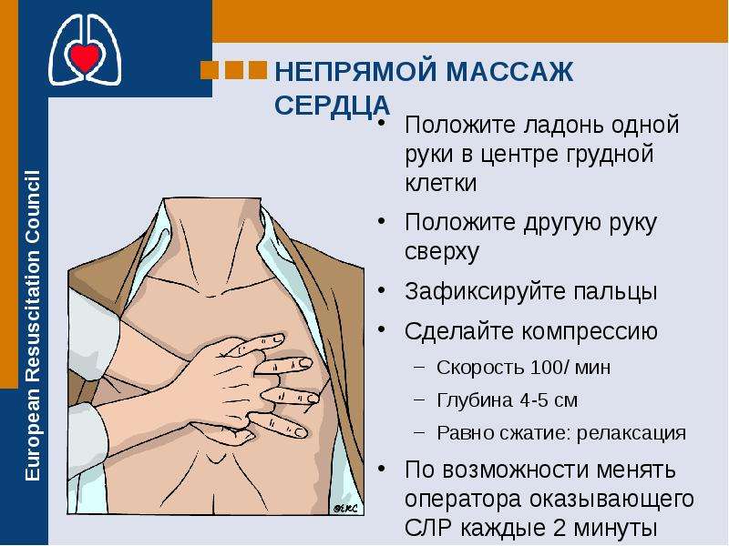 Какой должна быть глубина продавливания грудной клетки. Частота нажатий на грудную клетку при непрямом массаже сердца. Глубина при проведении непрямого массажа сердца. При проведении непрямого массажа сердца ладони располагаются. Положение рук реаниматора при проведении непрямого массажа сердца.