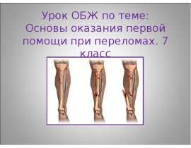 Урок ОБЖ по теме: Основы оказания первой помощи при переломах. 7 класс