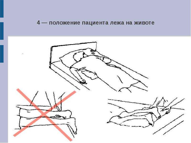 Больной находится в вынужденном положении сидит на краю кровати опираясь руками о колени