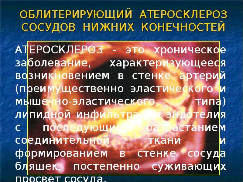 Ишемия нижних конечностей мкб