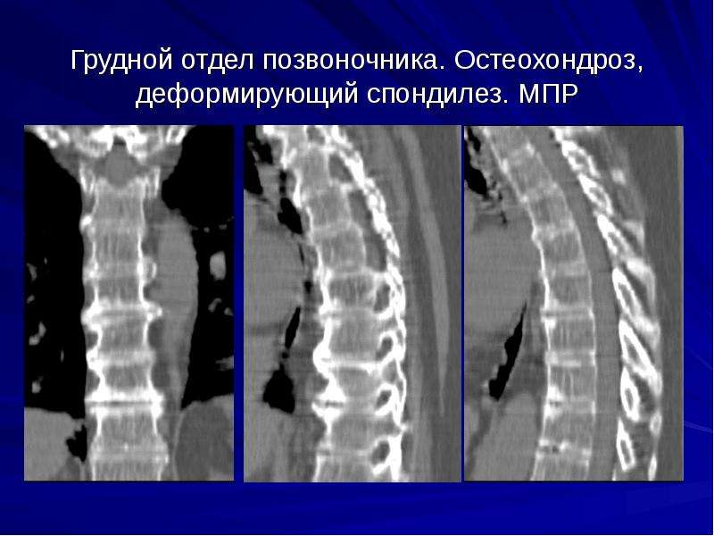 Система как компьютерная помощь в диагностике заболеваний на основе построения