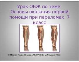Урок ОБЖ по теме: Основы оказания первой помощи при переломах. 7 класс