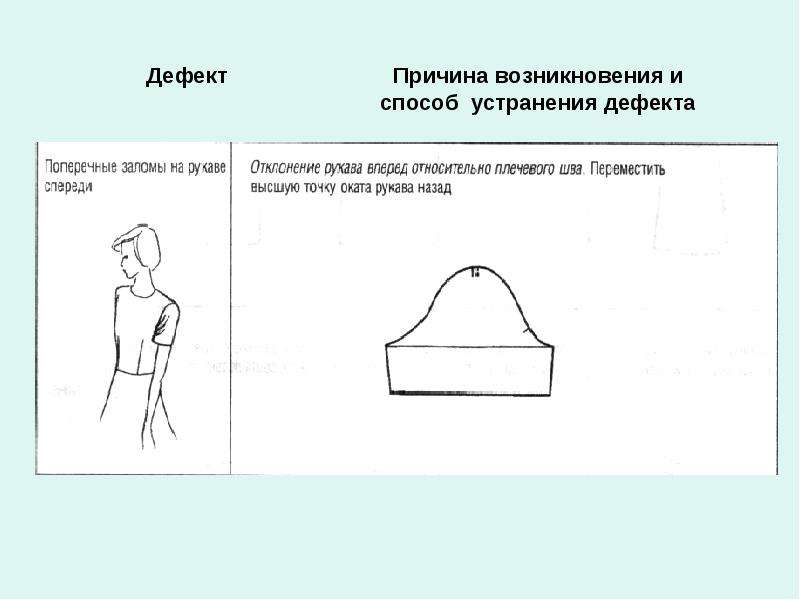 Дефекты трикотажных изделий презентация