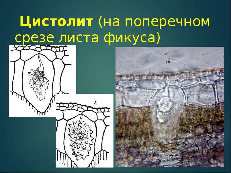 Срез фикуса. Поперечный срез листа цистолиты. Поперечный срез листа Рафиды. Цистолиты микроскопия. Поперечный срез листа фикуса.