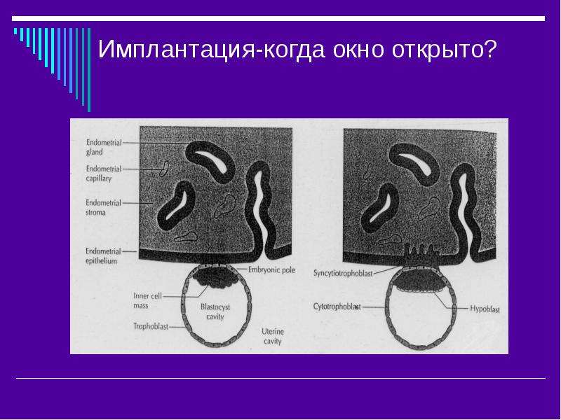 Имплантация беременность. Имплантационное окно. Окно имплантации при криопереносе. Окно имплантации при эко в криопротоколе. Признаки имплантационного окна.