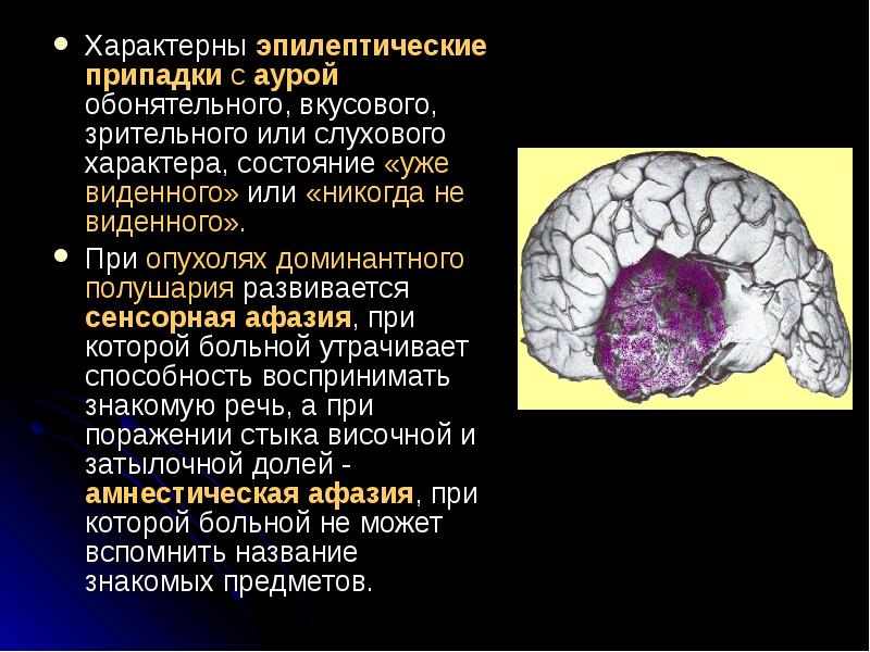 Опухоль мозга презентация