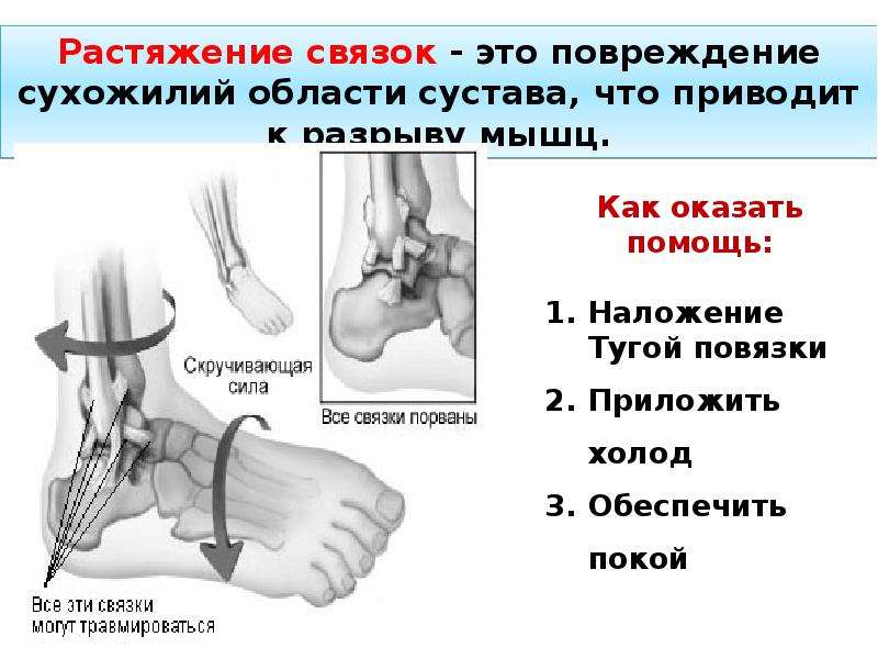 Презентация ушибы и вывихи