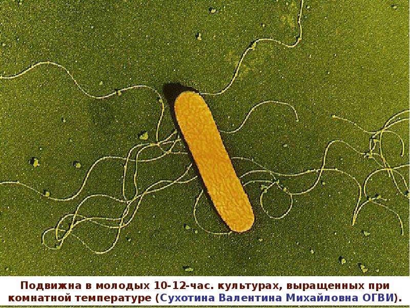 Презентация листериоз животных