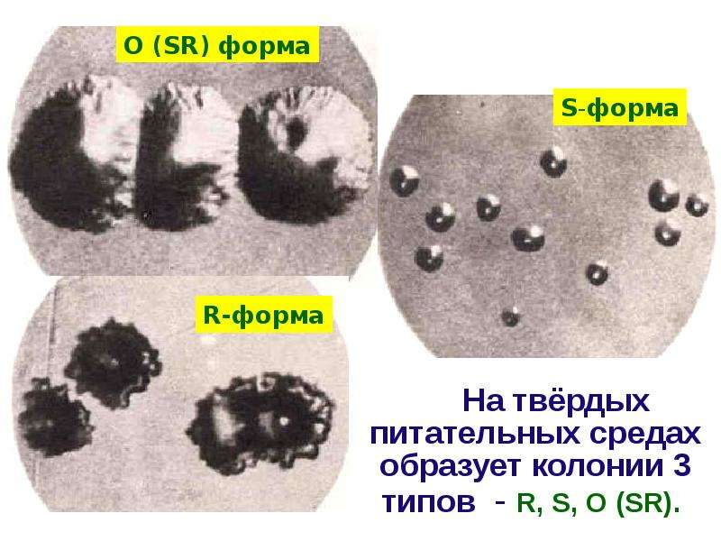 Презентация листериоз животных