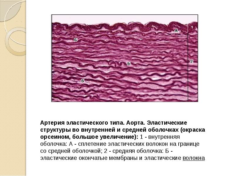 Артерия эластического типа рисунок