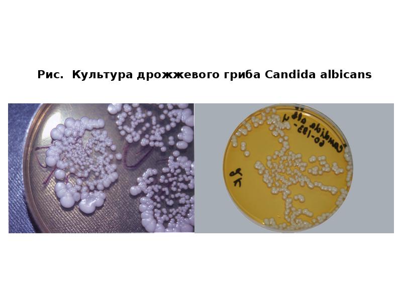 Рис. Культура дрожжевого гриба Candida albicans