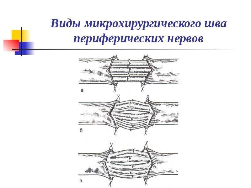 Основы пластической хирургии и трансплантологии презентация