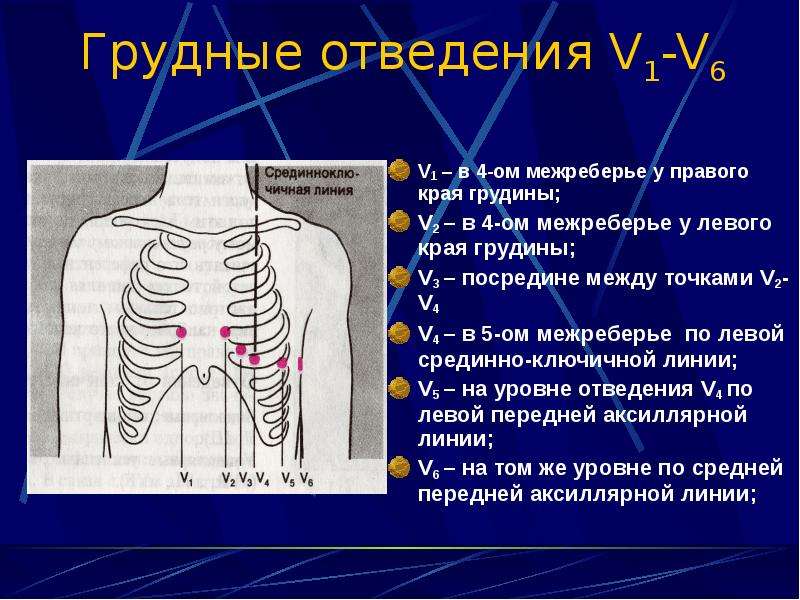 Грудины 5. Второе межреберье. Четвертое межреберье. Левые грудные отведения на ЭКГ. Левое межреберье.