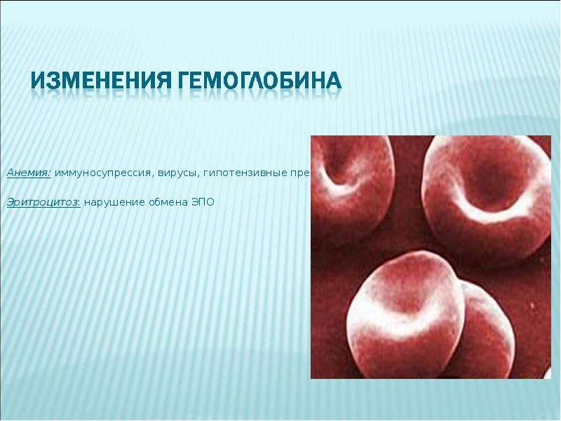 


Анемия: иммуносупрессия, вирусы, гипотензивные препараты
Анемия: иммуносупрессия, вирусы, гипотензивные препараты
Эритроцитоз: нарушение обмена ЭПО
