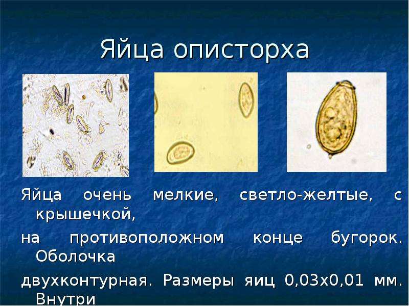 Яйца сосальщиков. Яйца кошачьего сосальщика микроскоп. Opisthorchis felineus яйца. Яйцо Сибирского сосальщика. Яйца кошачьего сосальщика под микроскопом.