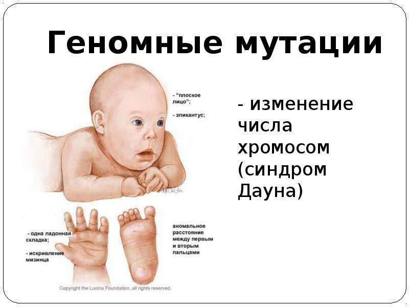 Геномные мутации проект