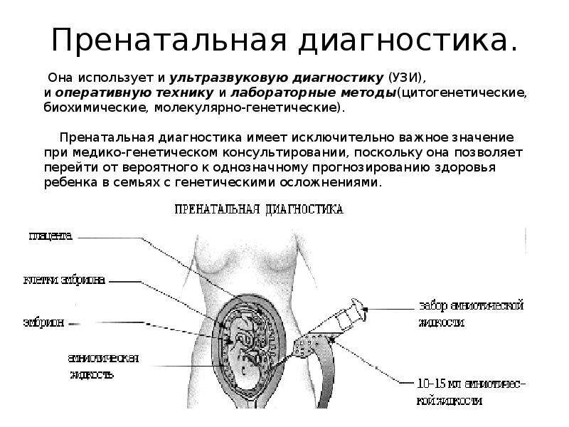 Методы пренатальной диагностики презентация генетика