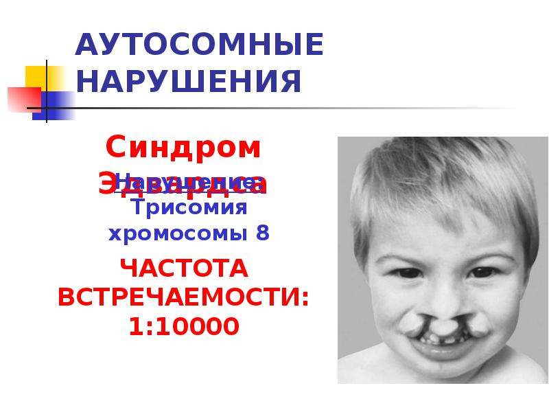 Синдром де