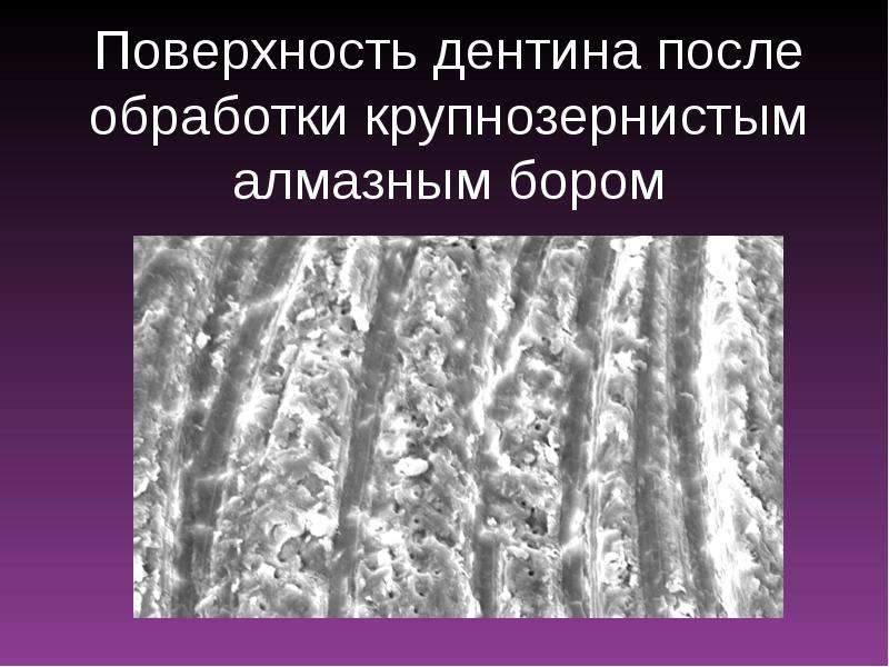 Адгезия к дентину. Дентин алмазный Бор. Электропроводимость твёрдых тканей зуба. Абразивность горных пород. У какого материала самая высокая адгезия к твердым тканям зуба.