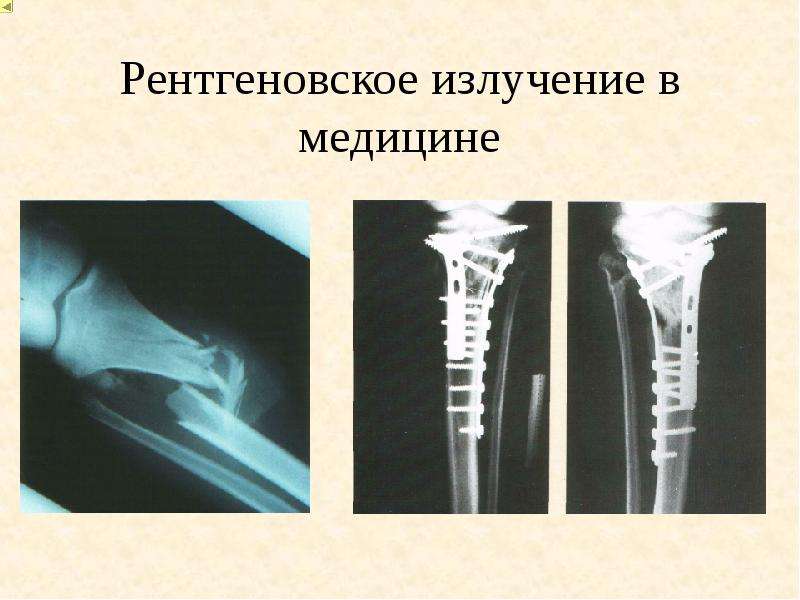 Презентация применение рентгеновского излучения в медицине