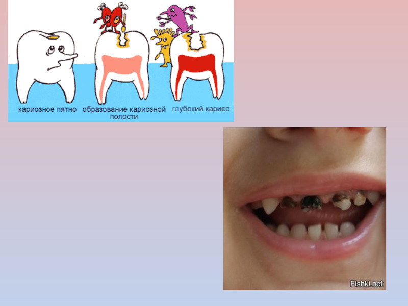 Презентация Берегите, дети, зубы, слайд №12