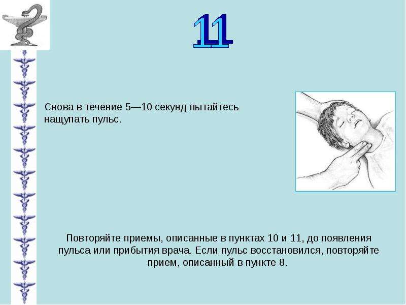 Пмп при остановке сердца презентация