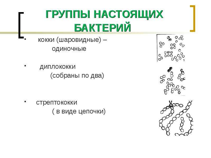 Общая характеристика бактерий презентация