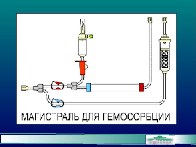 Ионной детоксикации. Экстракорпоральные методы детоксикации. Самостоятельная медицинская детоксикация схема. Экстракорпоральные магистрали. Экстракорпоральное подключение гетерогенных органов.