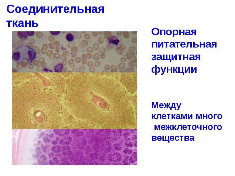 Защитную функцию выполняют ткани. Опорная соединительная ткань. Межклеточное вещество пигментной соединительной ткани. Эпителиальная ткань и соединительная ткань. Защитные клетки соединительной ткани.