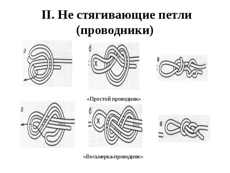 Просто проводник. Петли стягивающие. Стягивающая петля осложнения. Петлепроводник.